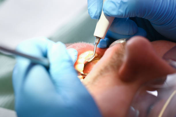 Best Tooth Infection Emergency Dentist  in Macon, MO