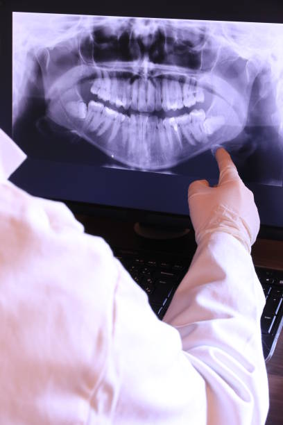 Best Teeth Whitening  in Macon, MO